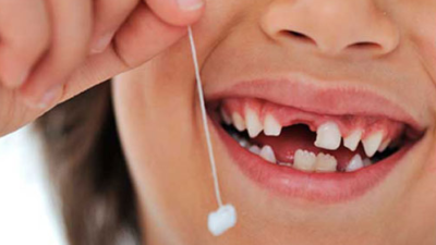 Dental Stem Cell Banking