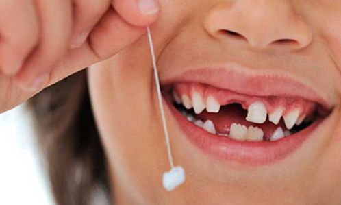 Dental Stem Cell Banking